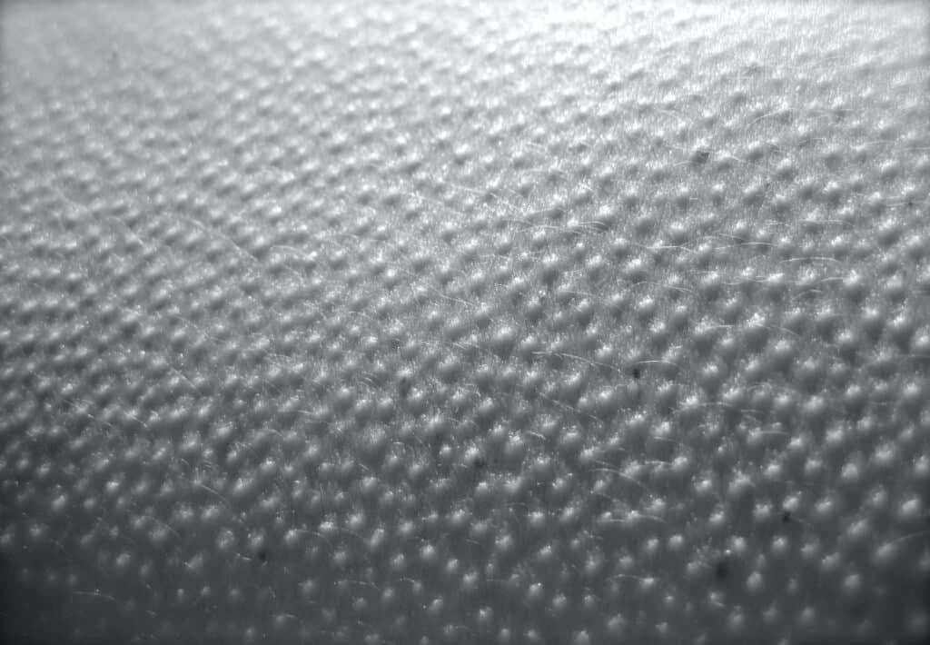 Chair de poule et intuition